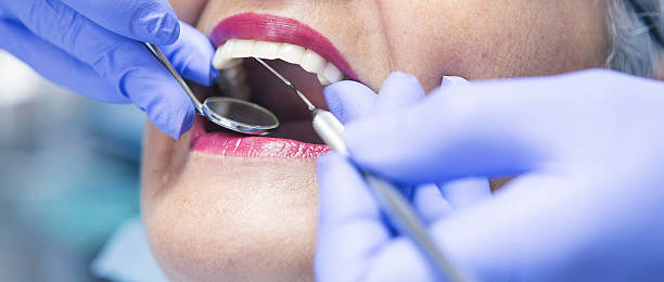 Best Knocked-Out Tooth Emergency  in Bakersfield Country Clu, CA